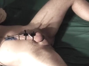 twenty one y/o e-stim & CBT