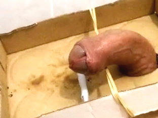 CBT burns not fast the pecker