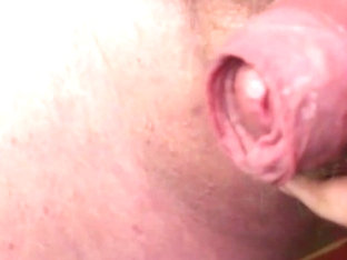 Foreskin with candy ball